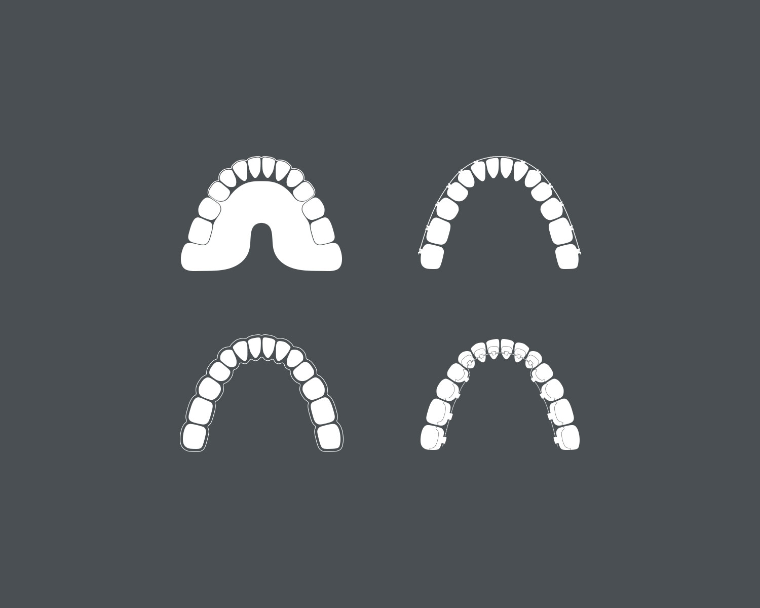 Behandlungsmethoden: Invisalign und Zahnspangen